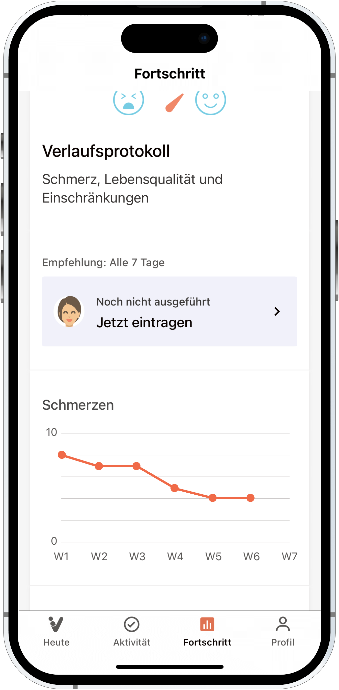 Anleitung: Fortschritt